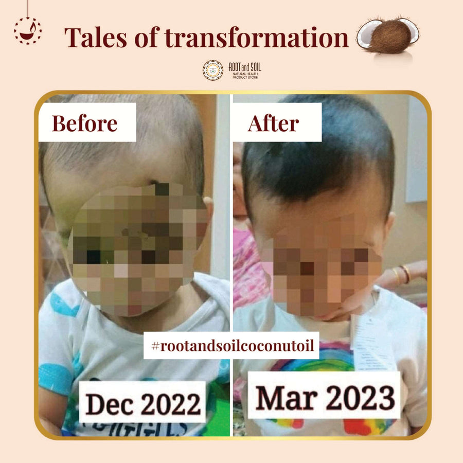 Coconut hair oil for babies - 0+ months